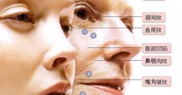 肉毒素注射培训