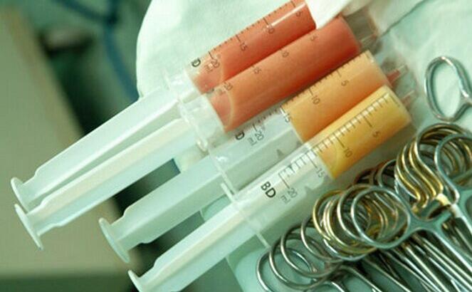 自体脂肪填充培训