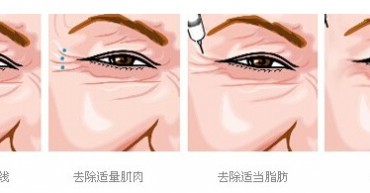 最爱微整形项目