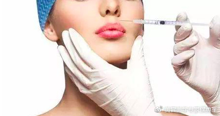 打玻尿酸