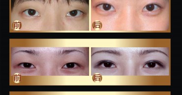 美容外科对比图_页面_56