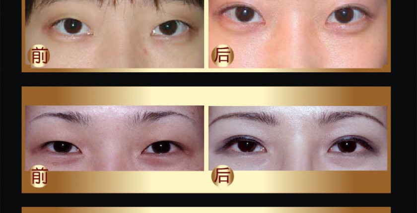 美容外科对比图_页面_56