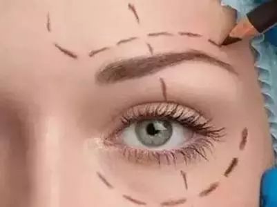 Aa7C-hfvkitw4768837-1