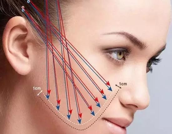 Fs7M-heqpwqy8557312-1