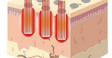 73FDD0B22EEDF924BF65D65E8B2300F66F3BAA30_size16_w405_h348