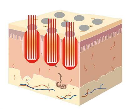 73FDD0B22EEDF924BF65D65E8B2300F66F3BAA30_size16_w405_h348