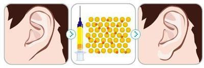 37003DFFA5C8B617F8A22658A807654662B3D675_size10_w400_h133