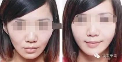 498A24D3079E7FFCFBE26A9AE57AF4C1E3F6D5A8_size13_w422_h214