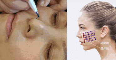 2E1DECF07B05BFC2297ECCE1BF91185F5D7D6D28_size728_w560_h314