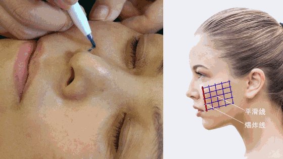 2E1DECF07B05BFC2297ECCE1BF91185F5D7D6D28_size728_w560_h314